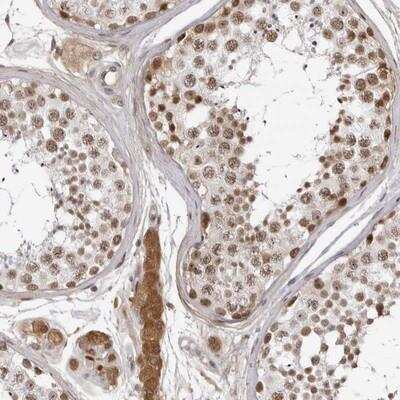 Immunohistochemistry: CNBD1 Antibody [NBP1-93826]