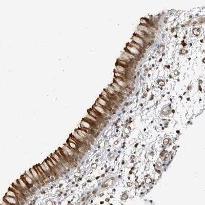 Immunohistochemistry-Paraffin: CNBD1 Antibody [NBP1-93827]