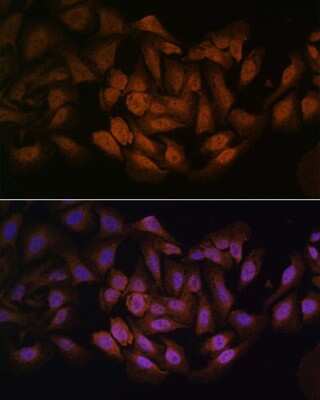 Immunocytochemistry/ Immunofluorescence: CNBP Antibody - Azide and BSA Free [NBP2-92206]