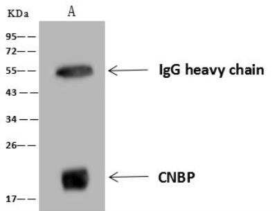 Immunoprecipitation: CNBP Antibody [NBP3-12678]