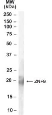 Western Blot: CNBP Antibody [NB600-983]