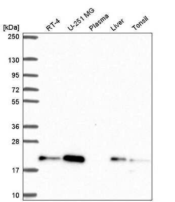 Western Blot: CNBP Antibody [NBP2-55690]