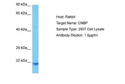 Western Blot: CNBP Antibody [NBP2-87197]