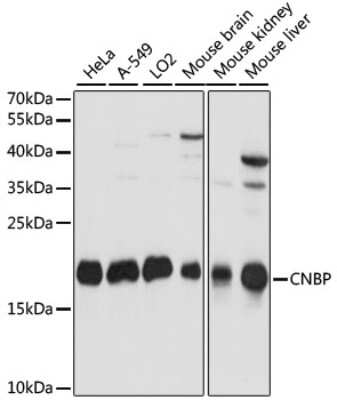 Western Blot: CNBP AntibodyAzide and BSA Free [NBP2-92206]