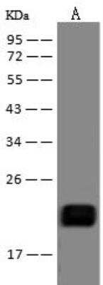 Western Blot: CNBP Antibody [NBP3-12678]