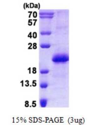 SDS-PAGE: Recombinant Human CNBP His Protein [NBP2-22742]