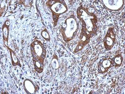 Immunohistochemistry-Paraffin: Carnosine Dipeptidase 1/CNDP1 Antibody [NBP2-15925]
