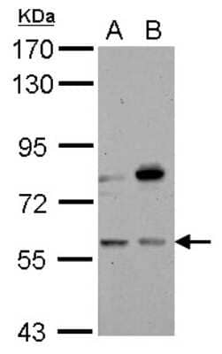 Western Blot: Carnosine Dipeptidase 1/CNDP1 Antibody [NBP2-15925]