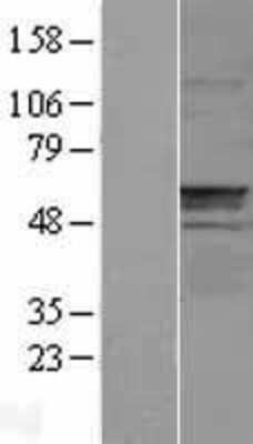 Western Blot: Carnosine Dipeptidase 1/CNDP1 Overexpression Lysate [NBL1-09307]