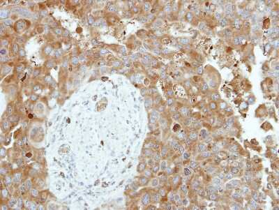 Immunohistochemistry-Paraffin: Cytosol Nonspecific Dipeptidase (CNDP2)/CPGL Antibody [NBP2-15926]