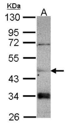 Western Blot: Cytosol Nonspecific Dipeptidase (CNDP2)/CPGL Antibody [NBP2-15926]