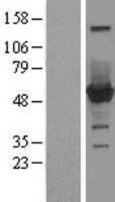 Western Blot: Cytosol Nonspecific Dipeptidase (CNDP2)/CPGL Overexpression Lysate [NBL1-09308]