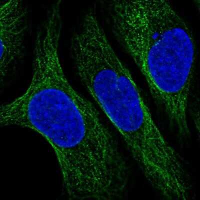 Immunocytochemistry/ Immunofluorescence: CNFN Antibody [NBP2-55563]