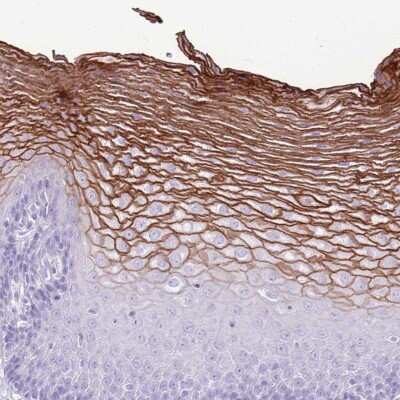 Immunohistochemistry-Paraffin: CNFN Antibody [NBP2-14668]