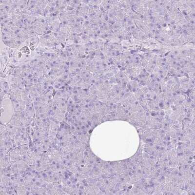 Immunohistochemistry-Paraffin: CNFN Antibody [NBP2-14668]