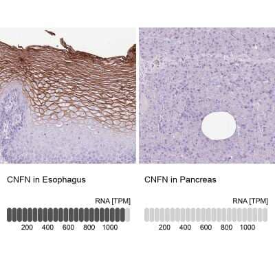 Immunohistochemistry-Paraffin: CNFN Antibody [NBP2-14668]