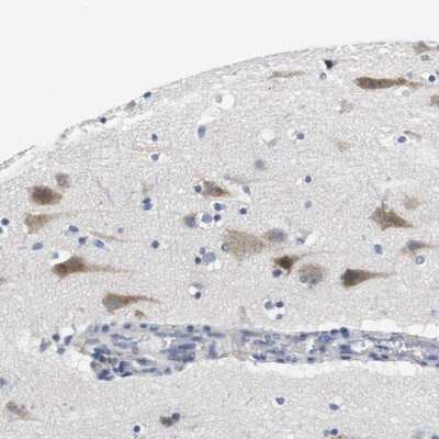 Immunohistochemistry-Paraffin: CNGA2 Antibody [NBP1-85527]