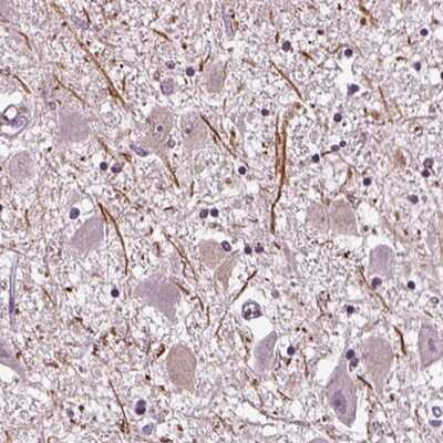 Immunohistochemistry-Paraffin: CNGA3 Antibody [NBP2-68684]