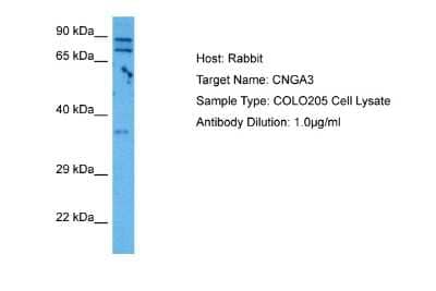 Western Blot: CNGA3 Antibody [NBP2-84701]