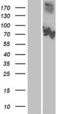 Western Blot: CNGA3 Overexpression Lysate [NBP2-09772]