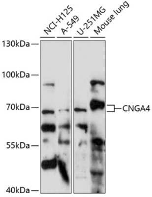 Western Blot: CNGA4 AntibodyAzide and BSA Free [NBP2-92183]