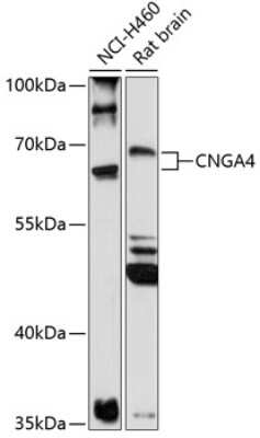 Western Blot: CNGA4 AntibodyAzide and BSA Free [NBP2-92184]