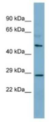 Western Blot: CNGA4 Antibody [NBP3-10583]