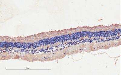 Immunohistochemistry-Paraffin: CNGB3 Antibody [NBP2-75087]