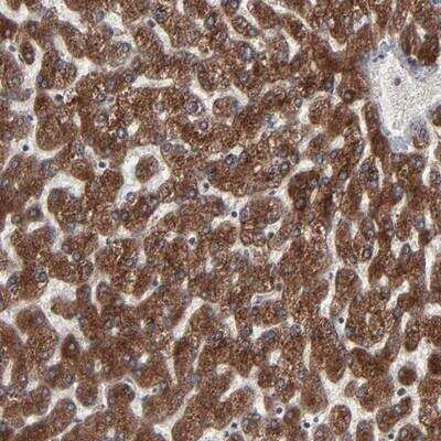 Immunohistochemistry-Paraffin: CNIH Antibody [NBP1-84422]