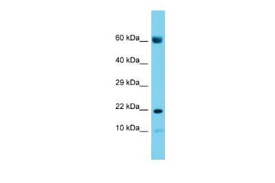 Western Blot: CNIH2 Antibody [NBP3-10717]