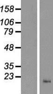 Western Blot: CNIH2 Overexpression Lysate [NBP2-04844]