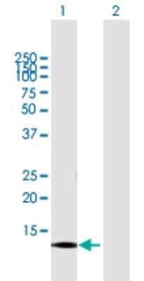 Western Blot: CNIH3 Antibody [H00149111-B01P]