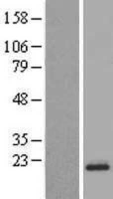 Western Blot: CNIH3 Overexpression Lysate [NBL1-09311]