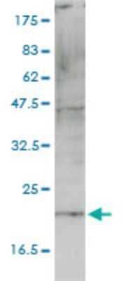 Western Blot: CNIH4 Antibody (4E10-1G4) [H00029097-M01]