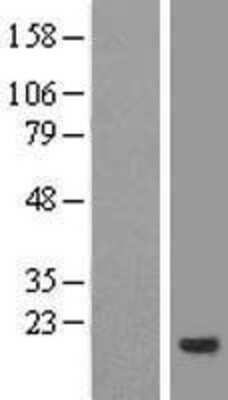 Western Blot: CNIH4 Overexpression Lysate [NBL1-09312]