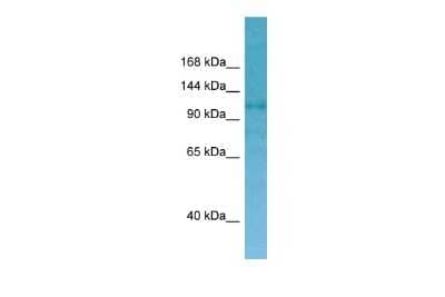 Western Blot: CNKR2 Antibody [NBP3-10685]