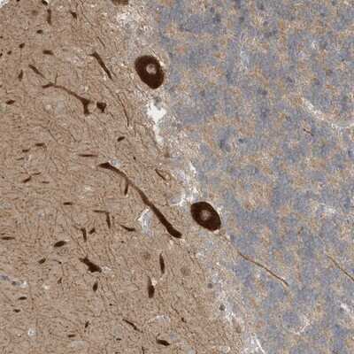 Immunohistochemistry-Paraffin: CNKSR1 Antibody [NBP1-84420]
