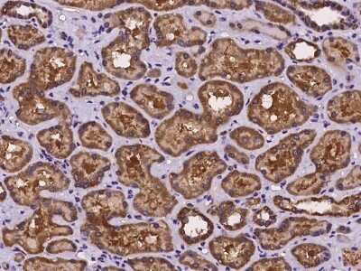 Immunohistochemistry-Paraffin: CNKSR1 Antibody [NBP2-97250]