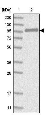 Western Blot: CNKSR1 Antibody [NBP1-84420]