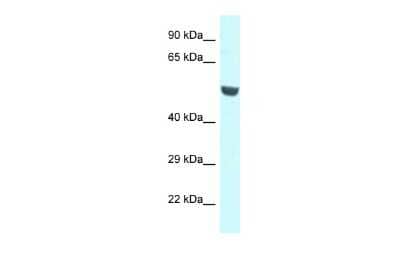 Western Blot: CNKSR1 Antibody [NBP2-84705]