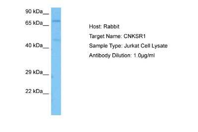 Western Blot: CNKSR1 Antibody [NBP2-84706]