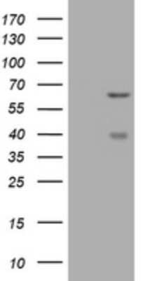 Western Blot: CNKSR3 Antibody (OTI1D7) [NBP2-45630]