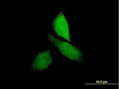 Immunocytochemistry/ Immunofluorescence: CNKSR3 Antibody [H00154043-B01P]