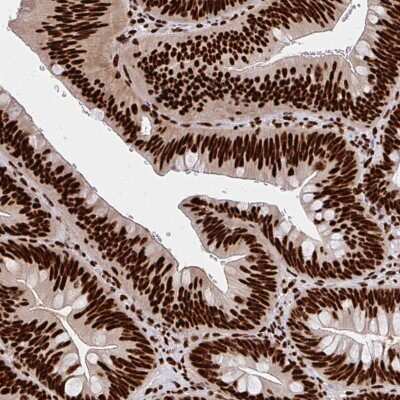 Immunohistochemistry-Paraffin: CNKSR3 Antibody [NBP2-48943]