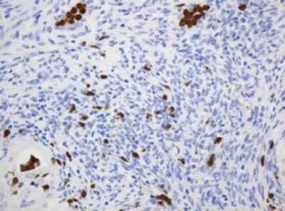 Immunohistochemistry: CNKSR3 Antibody (OTI1D7) - Azide and BSA Free [NBP2-72428]
