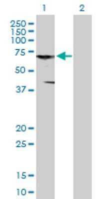 Western Blot: CNKSR3 Antibody [H00154043-B01P]