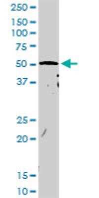 Western Blot: CNKSR3 Antibody [H00154043-D01P]