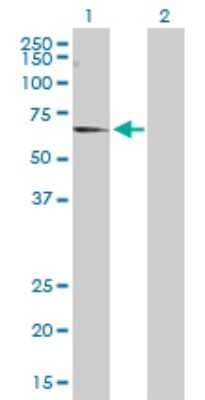 Western Blot: CNKSR3 Antibody [H00154043-D01P]