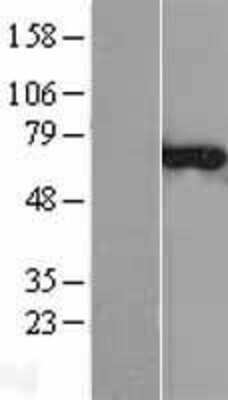 Western Blot: CNKSR3 Overexpression Lysate [NBL1-09313]