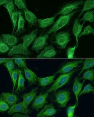 Immunocytochemistry/ Immunofluorescence: CNNM1 Antibody - Azide and BSA Free [NBP3-15497]